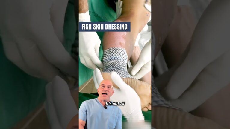 Fish Skin Band-Aid For Faster Burn Wound Healing 🔥 #shorts