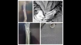 Orthopedic Surgery for Cats at Gulf Coast Qatar | Expert Vet Care for Your Feline Friend